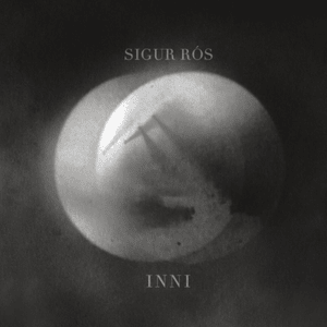 All Alright (Live) - Sigur Rós