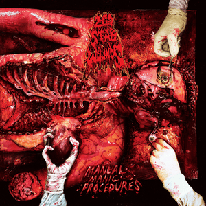 Flesh from Within - 200 Stab Wounds