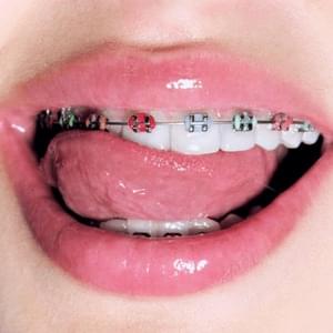 Брекеты (Sped-up) (Braces) - GAVRILINA