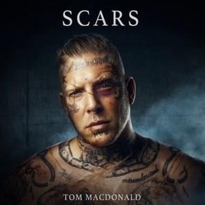 Scars - Tom MacDonald